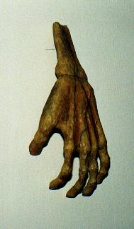 Hand